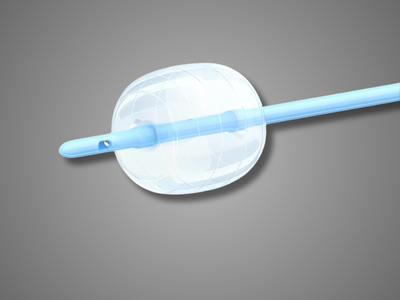 Disposable Triple-Lumen Stone Extraction Balloon